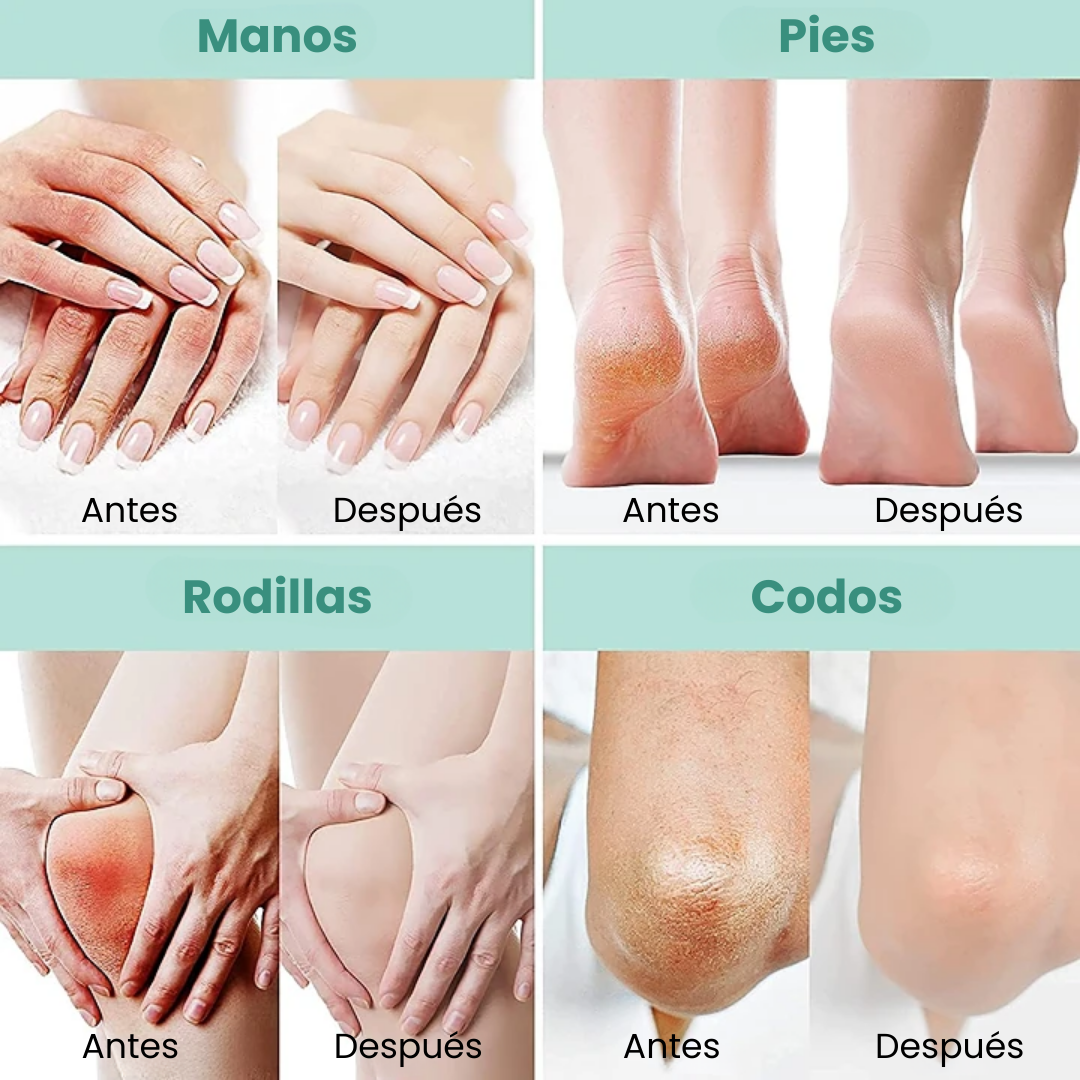 Crema al 40% Urea- Manos y Pies.